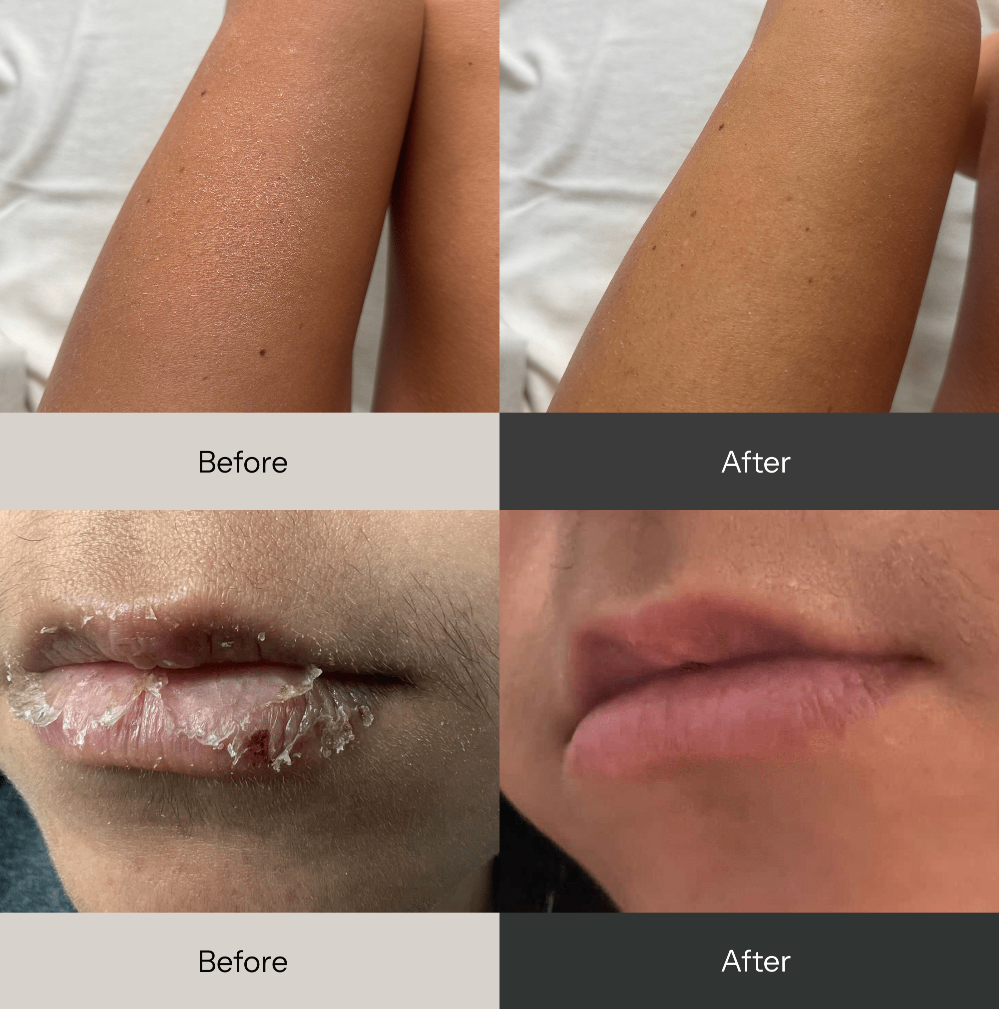 Universal - Multi-Purpose Balm